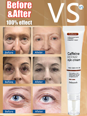 Instantly removes under eye bags,