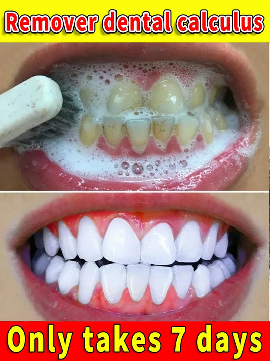 Toothpaste Whitening Tooth Remove  Stains